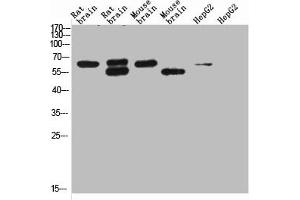 Western blot analysis of 1) Rat Brain Tissue-Low Molecular Protein Marker, 2)Rat Brain Tissue-High Molecular Protein Marker, 3) Mouse Brain Tissue-Low Molecular Protein Marker, 4) Mouse Brain Tissue- High Molecular Protein Marker, 5) HepG2-Low Molecular P (KCNH5 Antikörper)