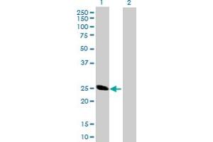 Western Blot analysis of BCAP29 expression in transfected 293T cell line by BCAP29 MaxPab polyclonal antibody. (BCAP29 Antikörper  (AA 1-241))