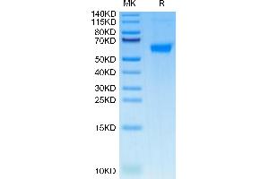 Human TNFRSF11B on Tris-Bis PAGE under reduced condition. (Osteoprotegerin Protein (AA 22-401) (His tag))