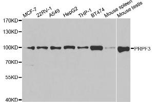 Western blot analysis of extracts of various cell lines, using PRPF3 antibody (ABIN5973192) at 1/1000 dilution. (PRPF3 Antikörper)