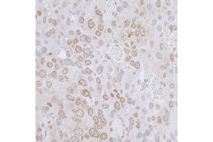 Immunohistochemistry (IHC) image for anti-LAP2 beta/tmpo (AA 225-275) antibody (ABIN7455055) (LAP2 beta/tmpo (AA 225-275) Antikörper)