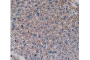 Used in DAB staining on fromalin fixed paraffin- embedded liver tissue (FOS Antikörper  (AA 6-240))