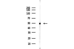 anti-StAR-Related Lipid Transfer (START) Domain Containing 3 (STARD3) (Internal Region) antibody