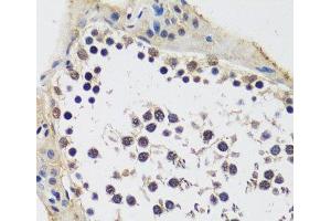 Immunohistochemistry of paraffin-embedded Rat testis using CCDC59 Polyclonal Antibody at dilution of 1:100 (40x lens). (CCDC59 Antikörper)