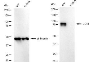 Western blotting analysis using CD44 antibody (ABIN7797973). (Rekombinanter CD44 Antikörper)