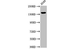 Western Blot Positive WB detected in: A549 whole cell lysate All lanes: PLIN4 antibody at 2. (PLIN4 Antikörper  (AA 308-418))