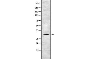 Western blot analysis of TSSC4 expression in HEK293 cells ,The lane on the left is treated with the antigen-specific peptide. (TSSC4 Antikörper  (C-Term))