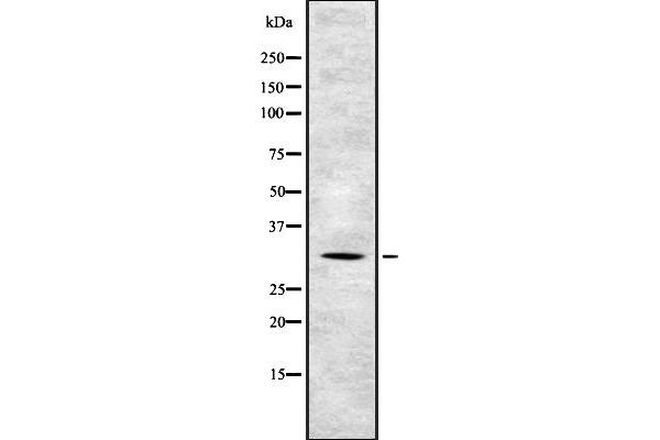 TSSC4 antibody  (C-Term)