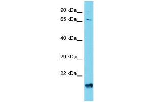 Host: Rabbit Target Name: AGAP4 Sample Type: HepG2 Whole Cell lysates Antibody Dilution: 1. (AGAP4 Antikörper  (C-Term))