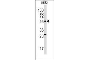 Western blot analysis of anti-CLIC5 Antibody in K562 cell line lysates (35ug/lane). (CLIC5 Antikörper)