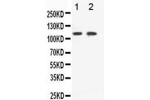 Anti-Eph receptor B3 antibody, Western blotting Lane 1: HELA Cell Lysate Lane 2: A549 Cell Lysate (EPH Receptor B3 Antikörper  (C-Term))