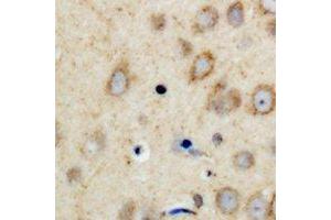 Immunohistochemical analysis of CPI17 staining in human brain formalin fixed paraffin embedded tissue section. (CPI-17 Antikörper  (N-Term))
