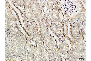 Formalin-fixed and paraffin embedded rat brain tissue labeled with Rabbit Anti-APG5L/ATG5 Polyclonal Antibody (ABIN752413) at 1:200 followed by conjugation to the secondary antibody and DAB staining. (ATG5 Antikörper  (AA 101-200))