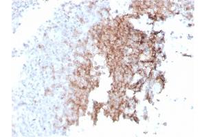 Formalin-fixed, paraffin-embedded human spleen stained with CD21 Recombinant Mouse Monoclonal Antibody (rCR2/1952). (Rekombinanter CD21 Antikörper  (AA 44-196))