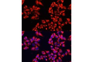 Immunofluorescence analysis of HeLa cells using  antibody (ABIN6133474, ABIN6136782, ABIN6136783 and ABIN6224731) at dilution of 1:100. (ALDH7A1 Antikörper  (AA 430-539))