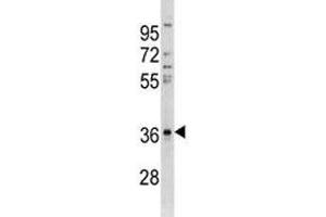 Anti-CTGF antibody western blot analysis in A549 lysate (CTGF Antikörper  (AA 166-193))
