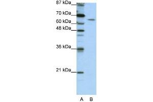 WB Suggested Anti-STAU1 Antibody Titration:  1. (STAU1/Staufen Antikörper  (N-Term))