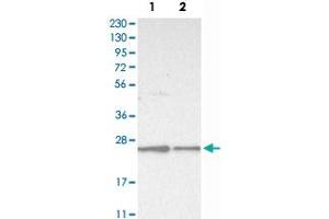 Western Blot analysis of Lane 1: RT-4 and Lane 2: U-251 MG sp cell lysates with VPS28 polyclonal antibody . (VPS28 Antikörper)