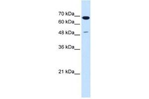 SILV antibody used at 1. (Melanoma gp100 Antikörper)