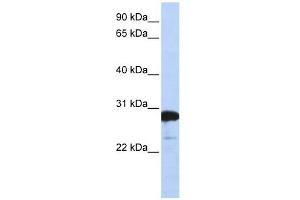 RanBP1 antibody used at 1 ug/ml to detect target protein. (RANBP1 Antikörper  (C-Term))