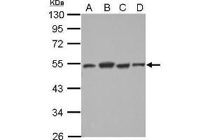 WB Image Sample (30 ug of whole cell lysate) A: NT2D1 B: PC-3 C: U87-MG D: SK-N-SH 10% SDS PAGE antibody diluted at 1:2000 (DTNBP1 Antikörper)