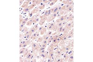 Immunohistochemistry (Paraffin-embedded Sections) (IHC (p)) image for anti-Protein Phosphatase 2 Regulatory Subunit 2A (PPP2R2A) (AA 43-71), (N-Term) antibody (ABIN1881683)