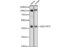 Western blot analysis of extracts of various cell lines, using SQS/FDFT1 antibody (ABIN6130393, ABIN6140567, ABIN6140568 and ABIN6221824) at 1:500 dilution. (FDFT1 Antikörper  (AA 1-260))