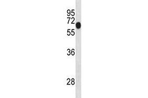 Dyrk1b antibody western blot analysis in mouse lung tissue lysate. (DYRK1B Antikörper  (AA 376-403))