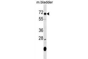 Western Blotting (WB) image for anti-Oxidative Stress Induced Growth Inhibitor 1 (OSGIN1) antibody (ABIN2999904) (OSGIN1 Antikörper)