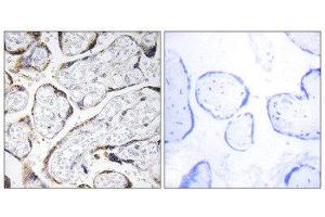Immunohistochemistry (IHC) image for anti-Fibulin 4 (FBLN4) (Internal Region) antibody (ABIN1851282) (FBLN4 Antikörper  (Internal Region))