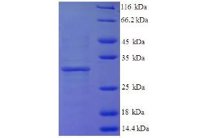 SDS-PAGE (SDS) image for Histone H3.3 (AA 2-136) protein (His-SUMO Tag) (ABIN5709639) (Histone H3.3 Protein (AA 2-136) (His-SUMO Tag))