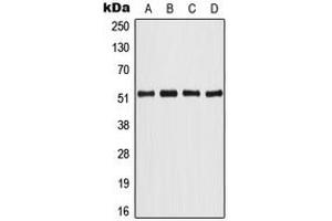 Western blot analysis of ATF2 expression in HeLa (A), NIH3T3 (B), PC12 (C), rat brain (D) whole cell lysates. (ATF2 Antikörper  (Center))