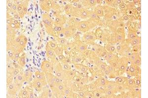 Immunohistochemistry of paraffin-embedded human liver tissue using ABIN7171658 at dilution of 1:100 (TBC1D7 Antikörper  (AA 1-293))