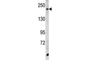 Western blot analysis of CPD antibody and HeLa lysate. (CPD Antikörper  (AA 1019-1048))
