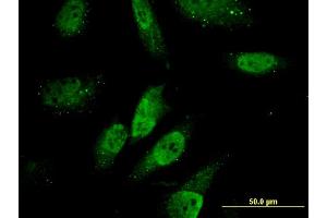 Immunofluorescence (IF) image for anti-Zinc Finger, HIT-Type Containing 3 (ZNHIT3) (AA 1-155) antibody (ABIN522780)