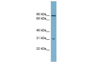WB Suggested Anti-ABCD2 Antibody Titration:  0. (CCL17 Antikörper  (Middle Region))