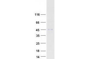 ABHD12 Protein (Transcript Variant 1) (Myc-DYKDDDDK Tag)