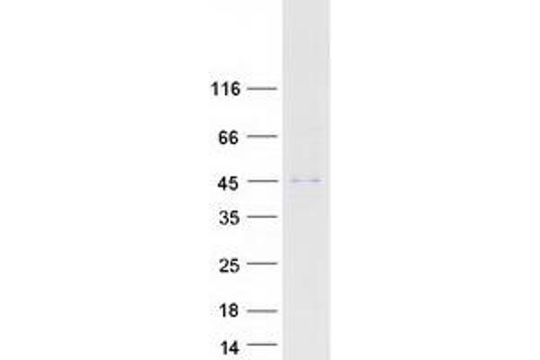 ABHD12 Protein (Transcript Variant 1) (Myc-DYKDDDDK Tag)