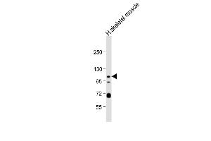Anti-KCNQ5 Antibody (C-term) at 1:1000 dilution + human skeletal muscle lysate Lysates/proteins at 20 μg per lane. (KCNQ5 Antikörper  (C-Term))