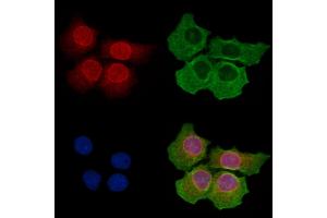 anti-Nucleoporin 210kDa (NUP210) (C-Term) antibody
