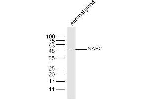 Mouse adrenal Gland lysates probed with NAB2 Polyclonal Antibody, Unconjugated  at 1:300 dilution and 4˚C overnight incubation. (NAB2 Antikörper  (AA 221-320))