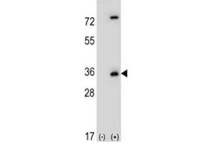 Western Blotting (WB) image for anti-Caspase 3 (CASP3) (AA 149-179) antibody (ABIN3030296)