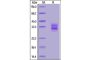 Mouse FOLR1, His Tag on  under reducing (R) condition. (FOLR1 Protein (AA 25-232) (His tag))