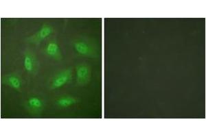 Immunofluorescence analysis of HeLa cells, using JAB1 Antibody. (COPS5 Antikörper  (AA 374-423))