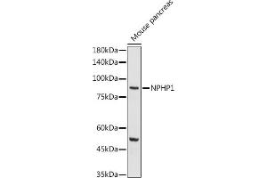 Western Blotting (WB) image for anti-Nephronophthisis 1 (Juvenile) (NPHP1) (AA 345-614) antibody (ABIN6144768)