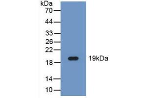 Western blot analysis of recombinant Human FADS2. (FADS2 Antikörper  (AA 1-130))