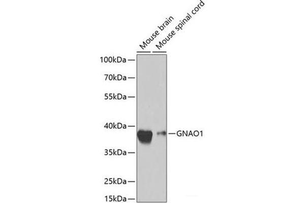 GNAO1 antibody