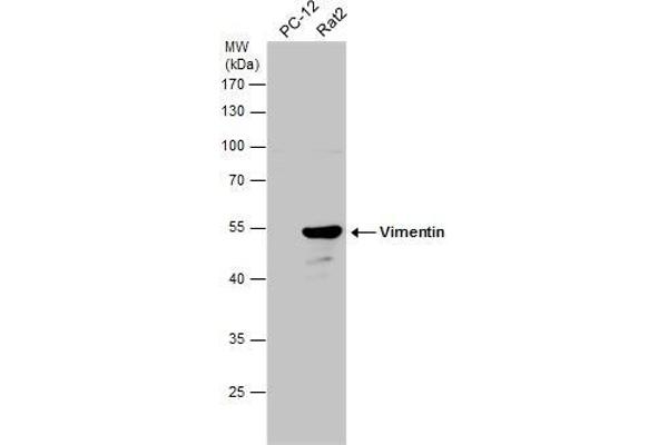 Vimentin Antikörper