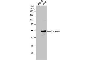 WB Image Various whole cell extracts (30 μg) were separated by 10% SDS-PAGE, and the membrane was blotted with Vimentin antibody , diluted at 1:10000.