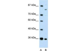 Western Blotting (WB) image for anti-Ankyrin Repeat and Zinc Finger Domain Containing 1 (ANKZF1) antibody (ABIN2461250) (ANKZF1 Antikörper)
